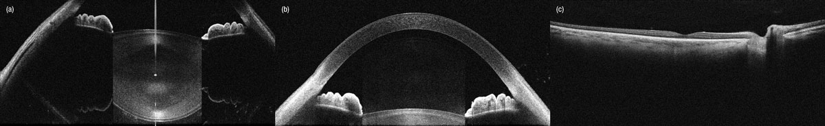 Thorlabs · Superluminescent Diode (SLD) Light Sources for OCT Systems